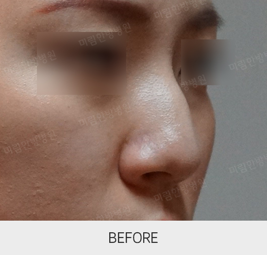 �Խñ� �����