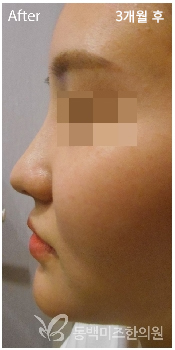 �Խñ� �����