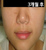 �Խñ� �����