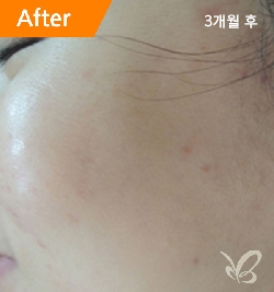 �Խñ� �����