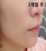 �Խñ� �����