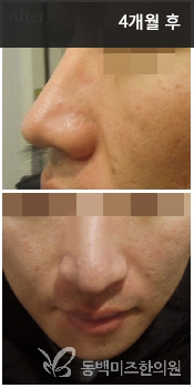 �Խñ� �����