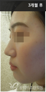 �Խñ� �����