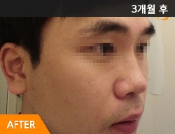 �Խñ� �����