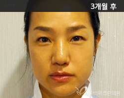 �Խñ� �����