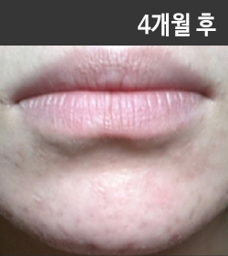 �Խñ� �����