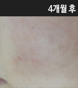 �Խñ� �����