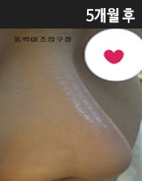 �Խñ� �����