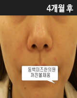 �Խñ� �����