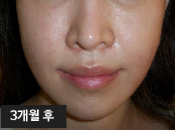 �Խñ� �����