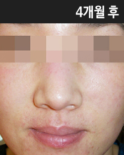 �Խñ� �����