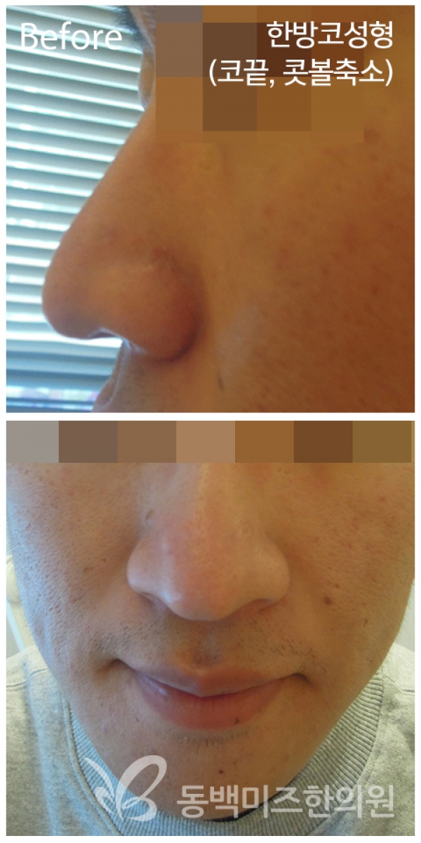 �Խñ� �����