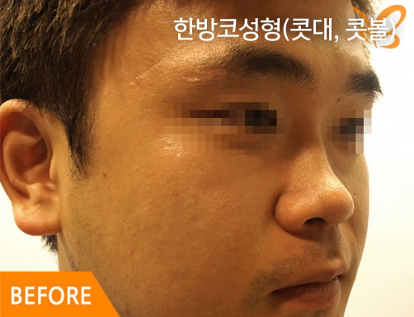 �Խñ� �����