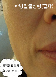 �Խñ� �����