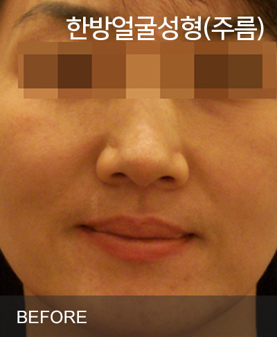 �Խñ� �����