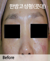 �Խñ� �����