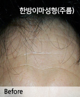 �Խñ� �����