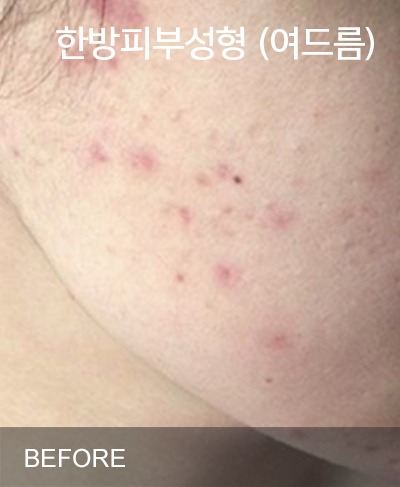 �Խñ� �����