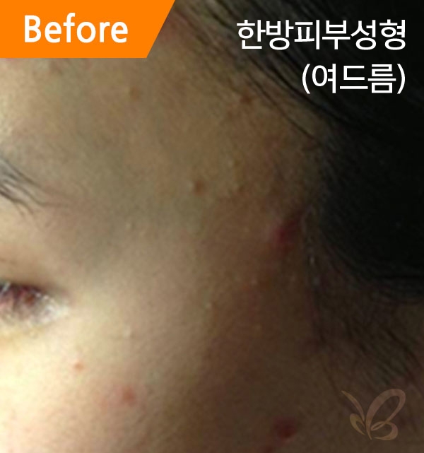 �Խñ� �����