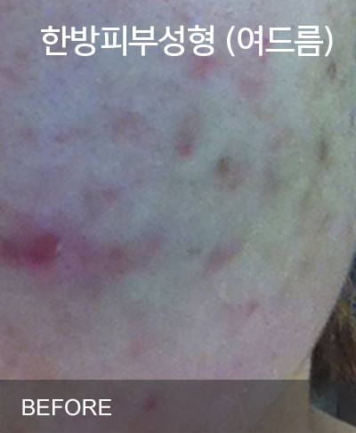 �Խñ� �����