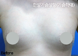 �Խñ� �����