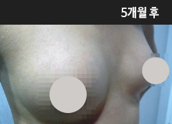 �Խñ� �����