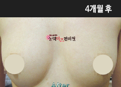 �Խñ� �����