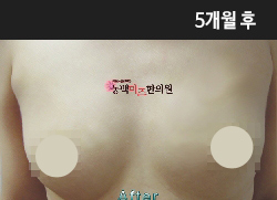 �Խñ� �����