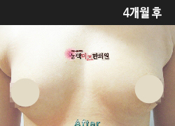 �Խñ� �����