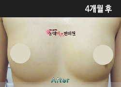 �Խñ� �����