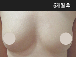 �Խñ� �����