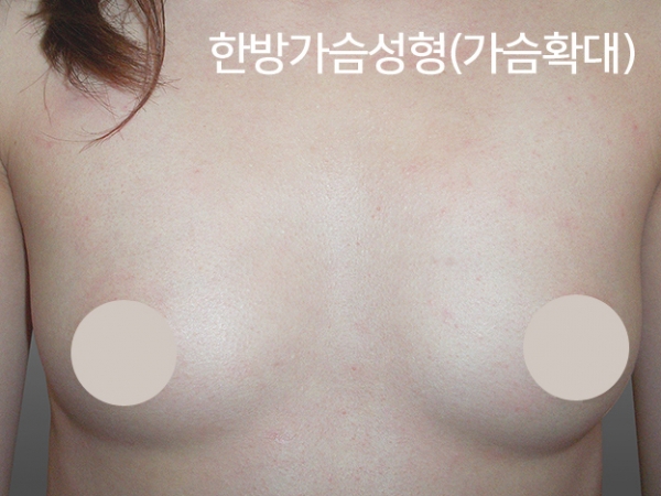 �Խñ� �����