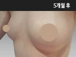 �Խñ� �����