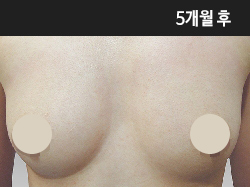 �Խñ� �����