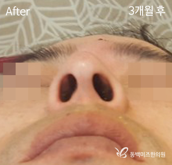 �Խñ� �����