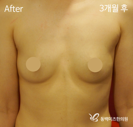 �Խñ� �����