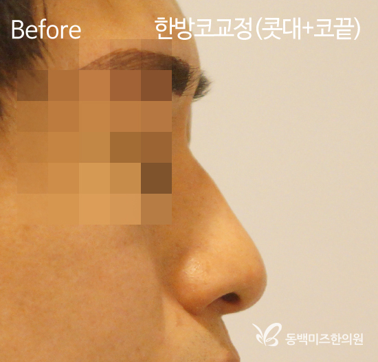 �Խñ� �����