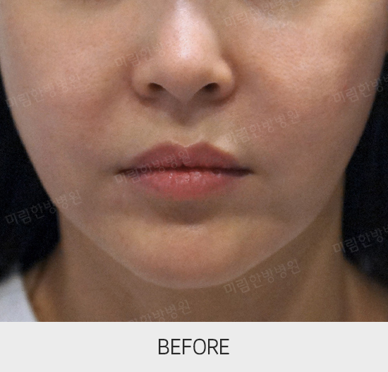 �Խñ� �����