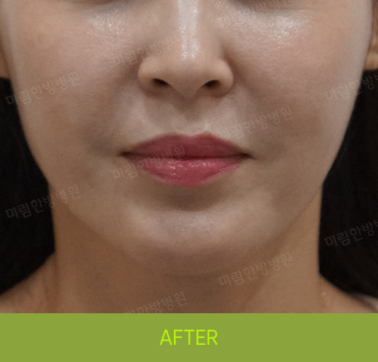 �Խñ� �����