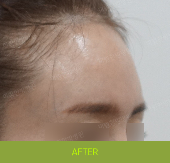 �Խñ� �����