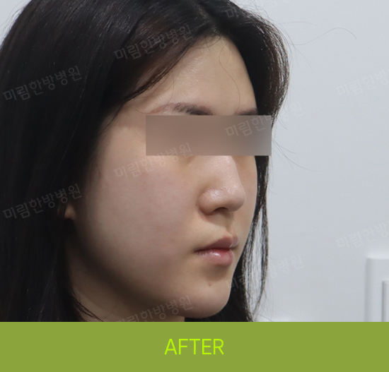 �Խñ� �����