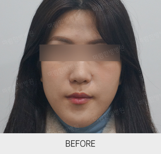 �Խñ� �����