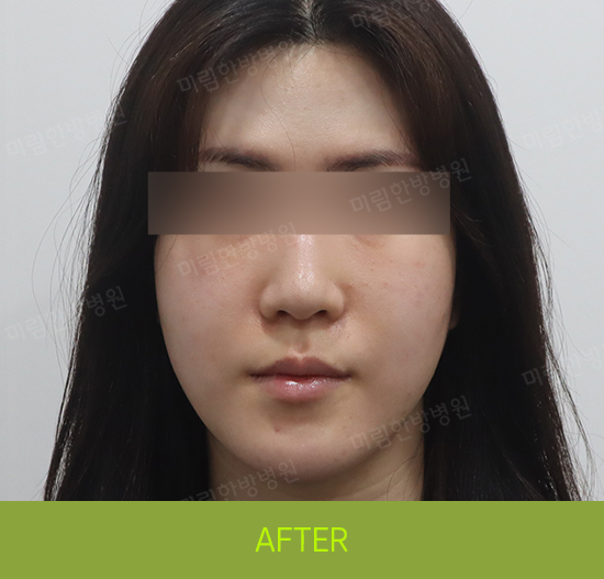 �Խñ� �����