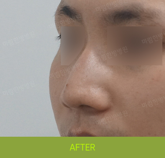 �Խñ� �����