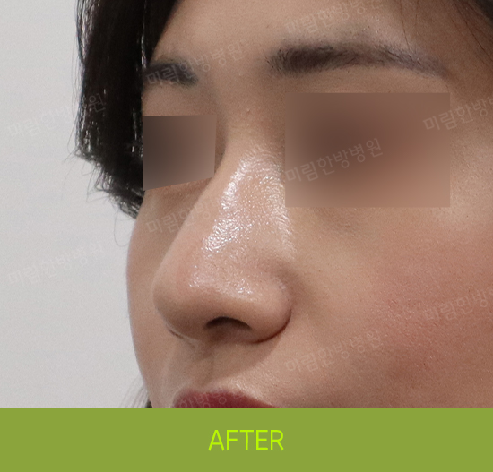 �Խñ� �����