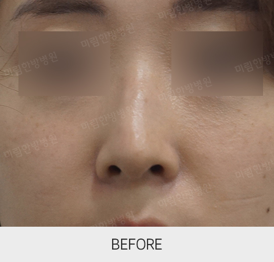 �Խñ� �����