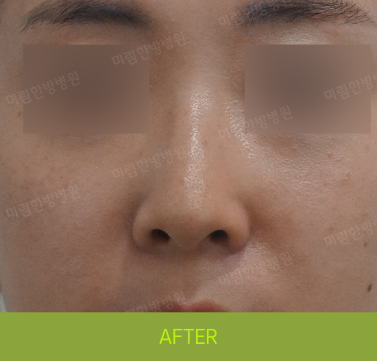 �Խñ� �����