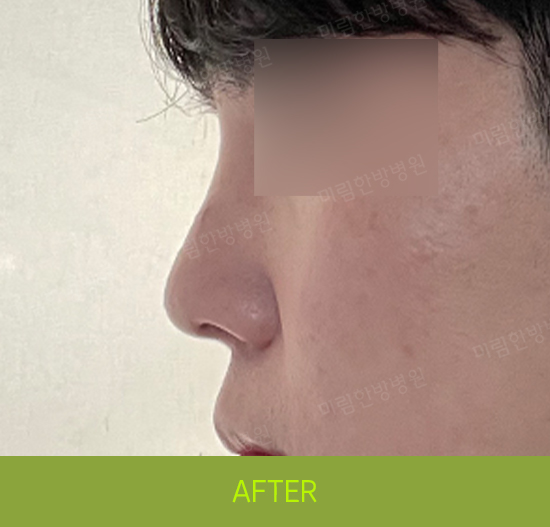 �Խñ� �����