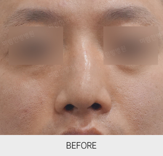 �Խñ� �����