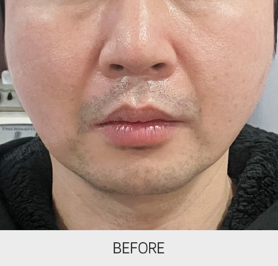 �Խñ� �����